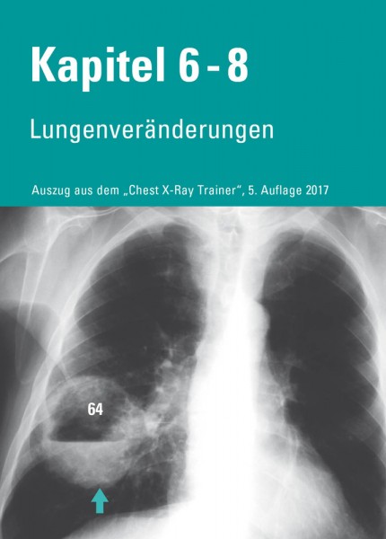 Chest X-Ray Trainer - Lungenveränderungen