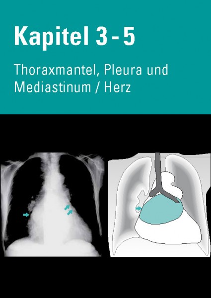 Chest X-Ray Trainer - Thoraxmantel, Pleura & Mediastinum / Herz
