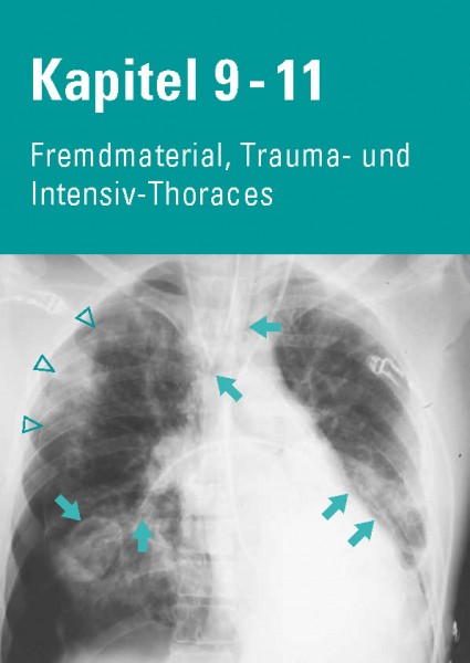 Chest X-Ray Trainer - Fremdmaterial, Trauma- & Intensiv-Thoraces