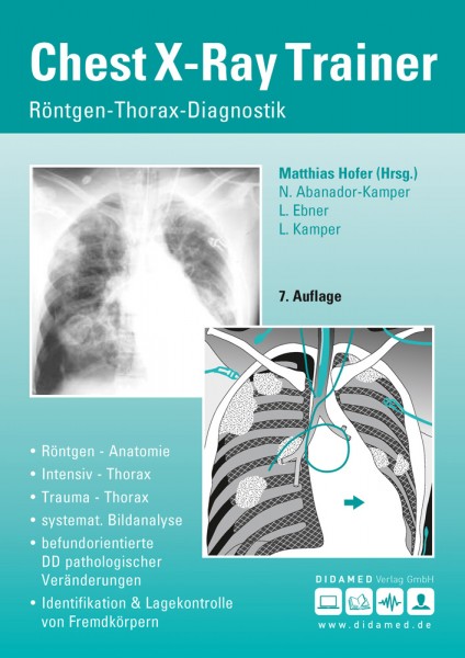 Chest X-Ray Trainer - Buch