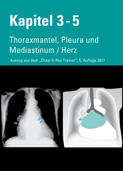 Chest X-Ray Trainer - Thoraxmantel, Pleura & Mediastinum / Herz