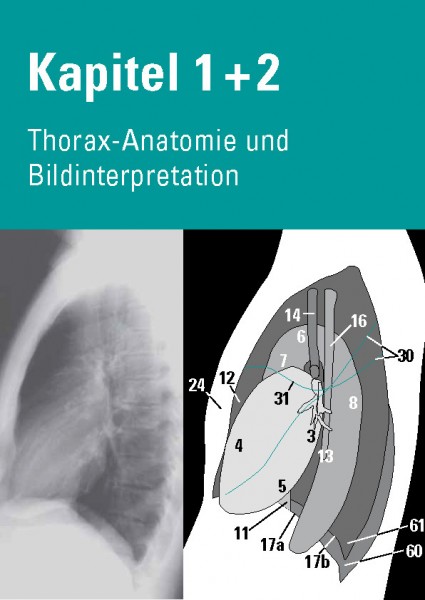 Chest X-Ray Trainer - Thorax-Anatomie & Bildinterpretation